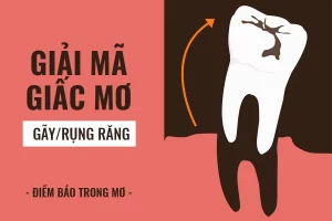 Giải Mã Giấc Mơ Rụng Răng Tại Yo88: Báo Hiệu Gì Cho Người Chơi?