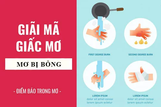 bong nuoc soi
