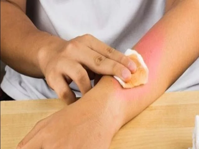 Mơ Thấy Bị Bỏng Nước Sôi Đánh Con Gì Tại Yo88? Giải Mã Giấc Mơ Và Gợi Ý Con Số May Mắn Mơ Thấy Bị Bỏng Nước Sôi Đánh Con Gì Tại Yo88? Giải Mã Giấc Mơ Và Gợi Ý Con Số May Mắn