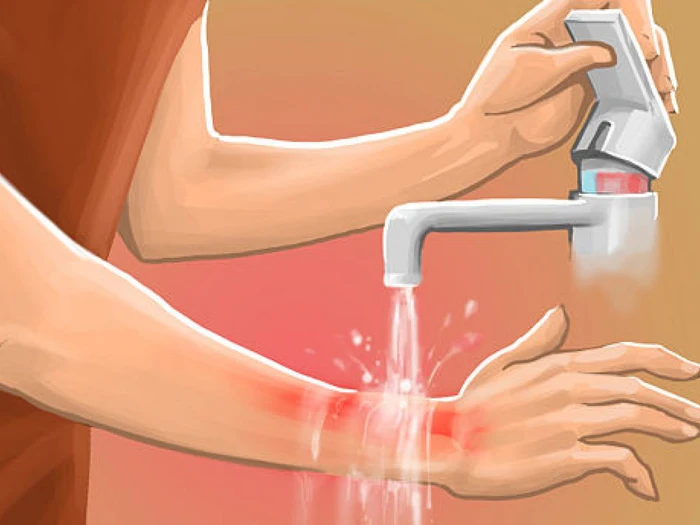 Mơ Thấy Bị Bỏng Nước Sôi Đánh Con Gì Tại Yo88? Giải Mã Giấc Mơ Và Gợi Ý Con Số May Mắn Mơ Thấy Bị Bỏng Nước Sôi Đánh Con Gì Tại Yo88? Giải Mã Giấc Mơ Và Gợi Ý Con Số May Mắn