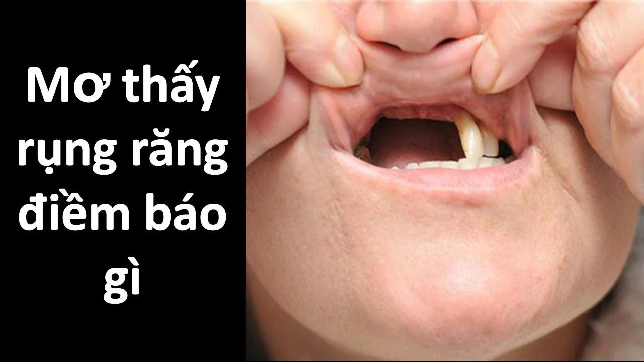 mơ rụng răng mơ rụng răng